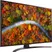 Smart Tivi LG 4K 43 Inch 43UP8100PTB ThinQ AI 1